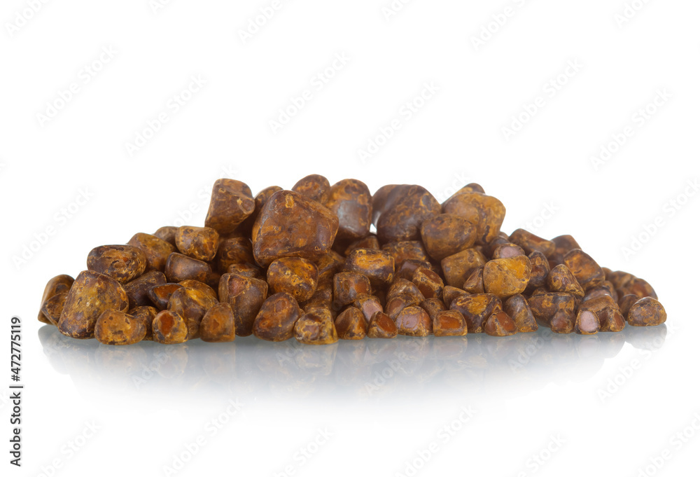 Cholelithiasis (gallstones) with gallbladder disease after cholecystectomy isolated on white Cholelithiasis (gallstones) with gallbladder disease after cholecystectomy isolated on white