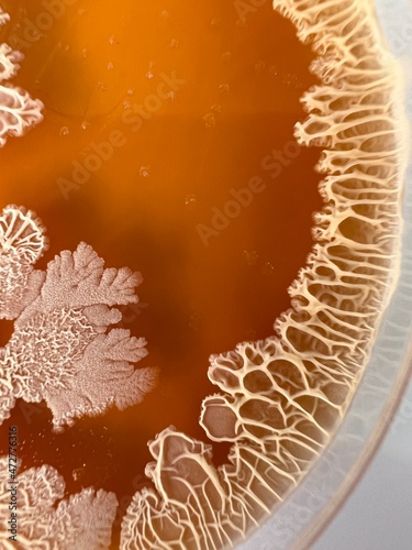 closeup photo of bacterial colonies grown on yello agar media