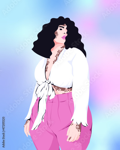 Plus size person with skin disorder expressing individuality 