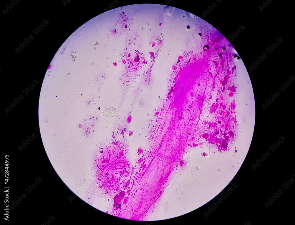 Gram staining, also called Gram's method, is a method of differentiating bacterial species into two large groups (Gram-positive and Gram-negative). Gram staining, also called Gram's method, is a method of differentiating bacterial species into two large groups (Gram-positive and Gram-negative).