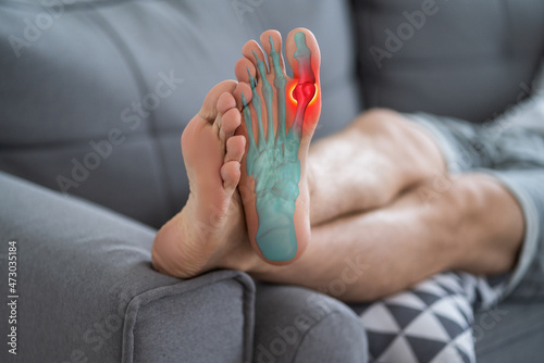 Joint diseases, hallux valgus, plantar fasciitis, man's leg hurts, pain in the foot photo