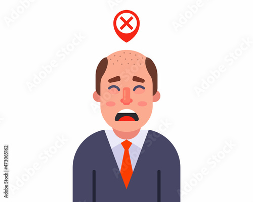 upset man with bald head. worry about hair loss. flat vector illustration.