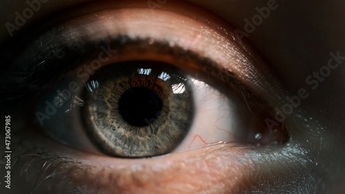 Women's Grey Eye with Brown Spot. Close-up.