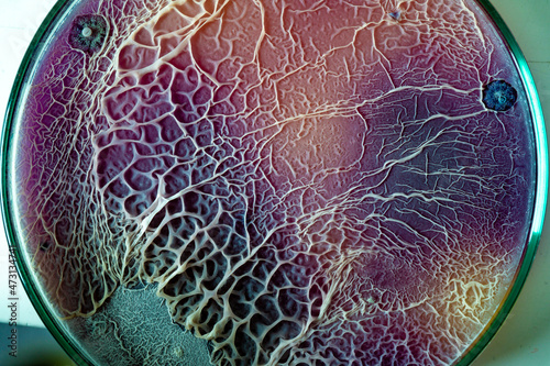 The texture of the bacterial film biofilm on a nutrient medium in a petri dish photo