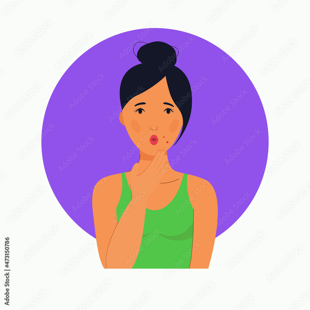 Portrait of a surprised girl with acne on her face in cartoon style on a white background Portrait of a surprised girl with acne on her face in cartoon style on a white background