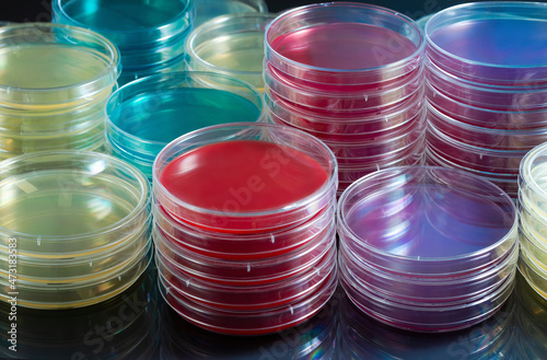Stove with plates with culture media for bacterial culture of samples in the lab. Collection of petri dishes with different culture medium photo