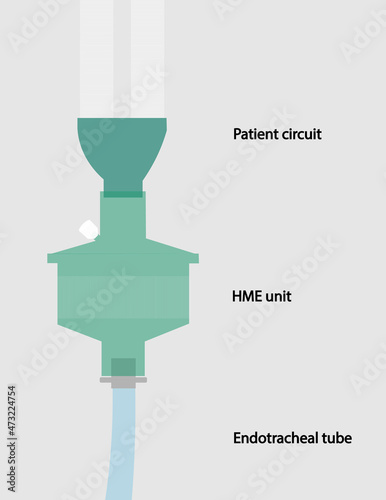 HME filter illustration. Connection the patient circuit, HME filter and endotracheal tube.