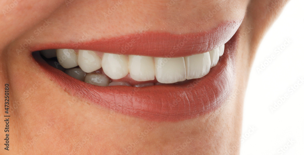 Obraz premium Smile design with zirconia crowns.