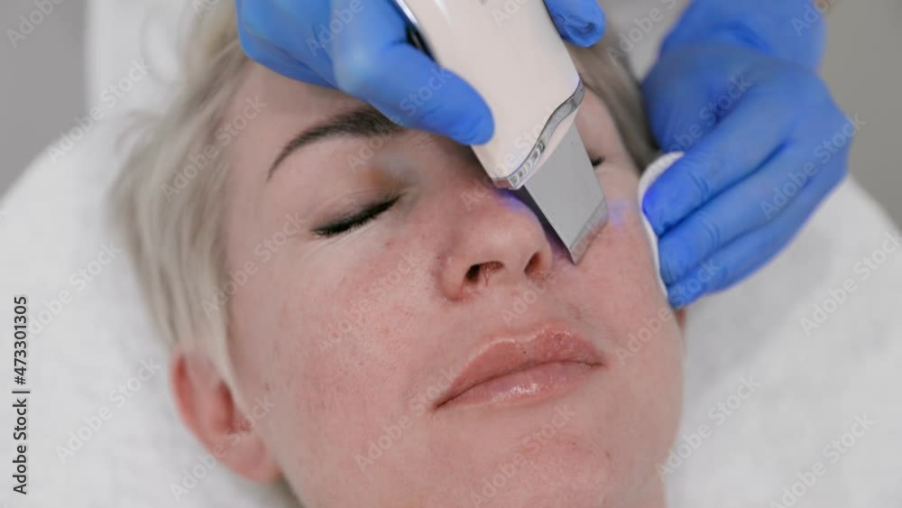 Ultrasonic peeling of the facial skin. Top view of a woman's face, close-up. Slow motion. The concept of professional skin care and cosmetology Ultrasonic peeling of the facial skin. Top view of a woman's face, close-up. Slow motion. The concept of professional skin care and cosmetology