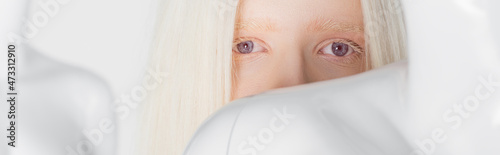 Blonde and albino woman looking at camera near mannequin isolated on white, banner. photo