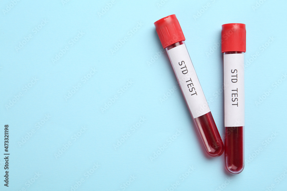 Tubes with blood samples and labels STD Test on light blue background, flat lay. Space for text Tubes with blood samples and labels STD Test on light blue background, flat lay. Space for text