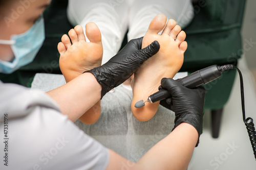 Peeling female feet. Hands of podiatry specialist in black gloves using special grinding equipment polish female foot from callus and corn in the beauty salon