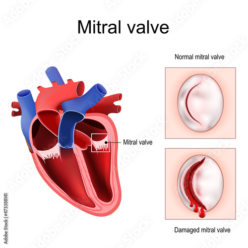 Heart anatomy. Mitral valve