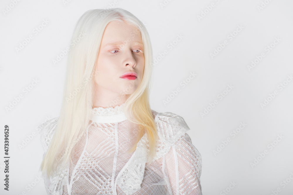 Albino woman in blouse looking away isolated on white. Albino woman in blouse looking away isolated on white.
