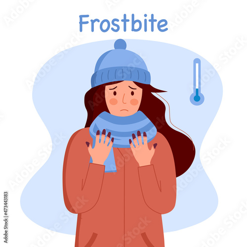 Woman suffering from frostbite. Female with frozen hands in winter season in flat design. Skin burn symptom.