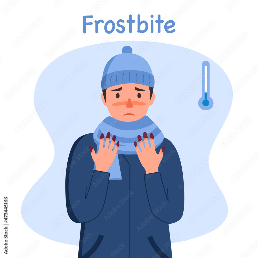Man suffering from frostbite. Guy with frozen hands in winter season in flat design. Skin burn symptom.