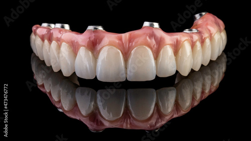 dentures on a black background, dental implants
 photo