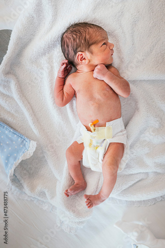 Top view of a newborn baby in hospital bed. The baby sleeps soundly.
