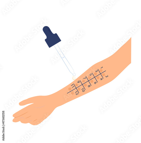 Allergy test vector stock illustration. Laboratory diagnostics for allergens by the drug. An injection test on the arm. Isolated on a white background. photo