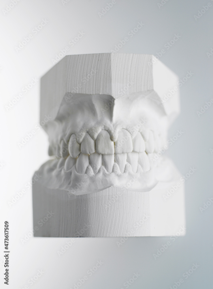 Set of plaster dental molds Stock Photo Adobe Stock