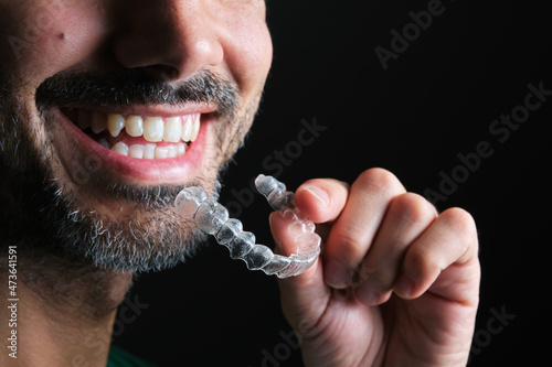 bearded guy putting on transparent dental retainer photo