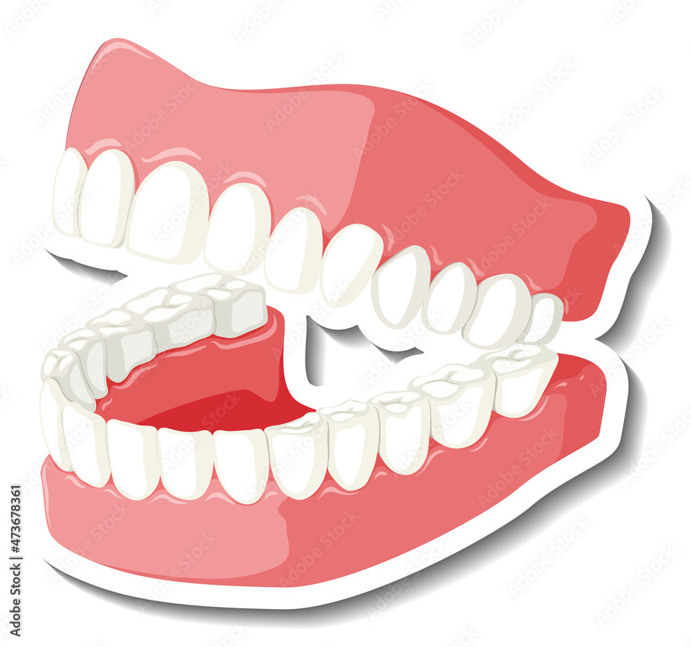 Teeth with gum model on white background Teeth with gum model on white background