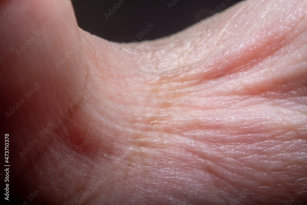 Fototapeta premium A close-up of the folds of skin at the folds of the fingers. Photo in soft focus at high magnification.