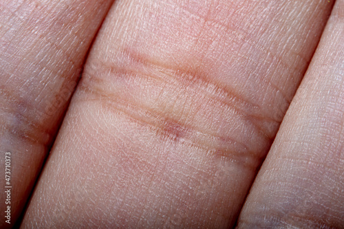 A close-up of the folds of skin at the folds of the fingers. Photo in soft focus at high magnification.