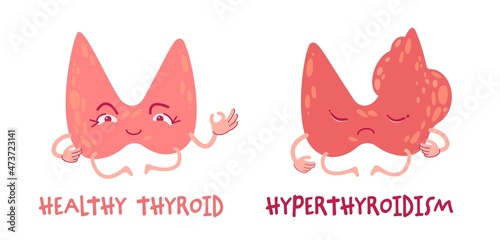 Healthy thyroid gland and hyperthyroidism, cartoon characters. Medical vector illustration. Endocrine system health