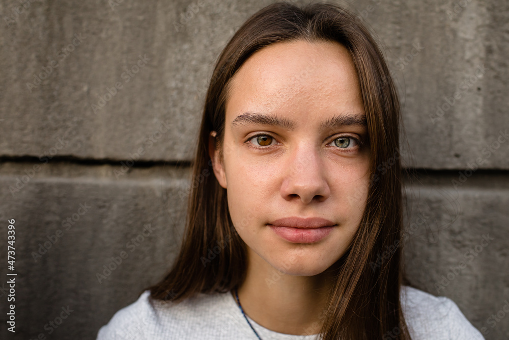 Heterochromia Stock Photo | Adobe Stock