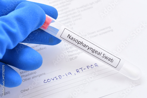 Nasopharyngeal swab from patient for COVID-19 test by using RT-PCR method  photo