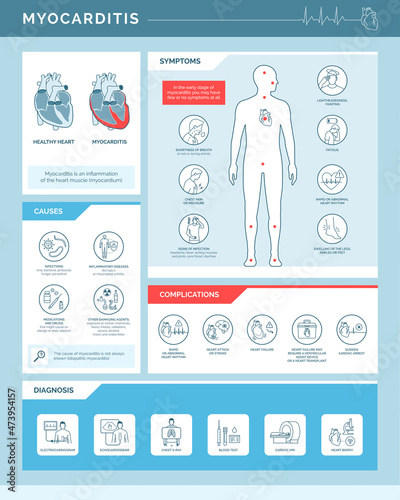 Myocarditis medical infographic with heart section
