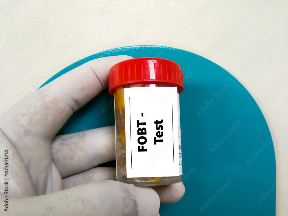 Fecal occult blood test (FOBT). Doctor holding sample container with