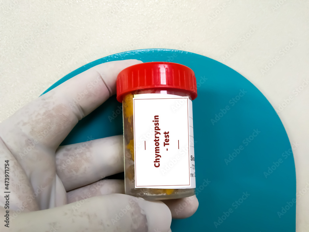 Stool sample in Plastic container for Chymotrypsin test(stool), Fecal