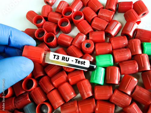 Blood sample tube for T3 resin uptake(T3RU) test,It measures the binding capacity of a hormone called thyroxin-binding globulin (TBG photo