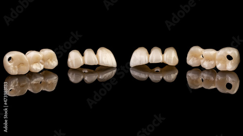 dental implants on a black background

