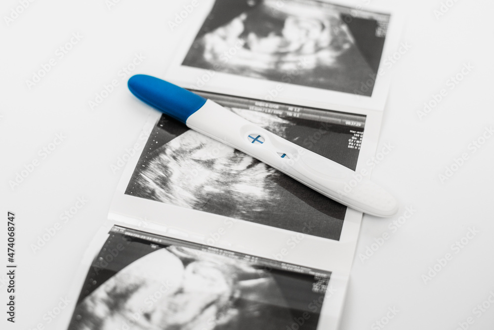 Positive pregnancy test on ultrasound photo. A positive pregnancy test
