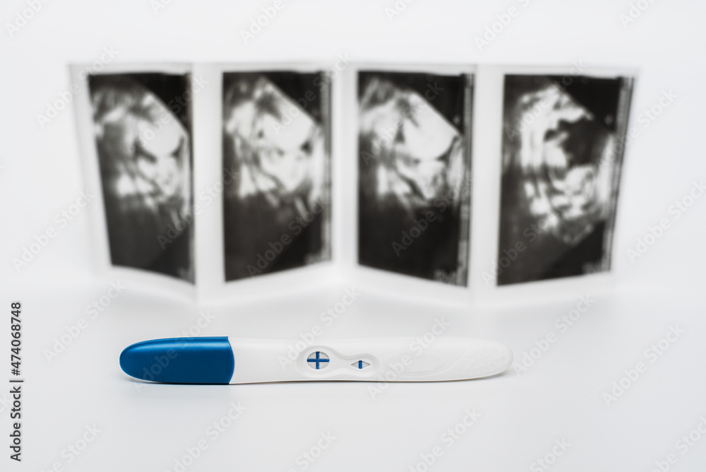 Positive pregnancy test on ultrasound photo. Positive pregnancy test