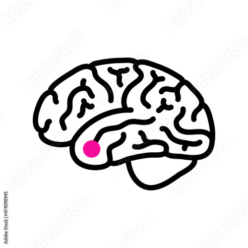 Pituitary adenoma cancer