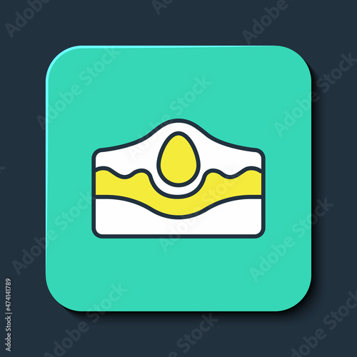 Filled outline Acne icon isolated on blue background. Inflamed pimple on the skin. The sebum in the clogged pore promotes the growth of a bacteria. Turquoise square button. Vector