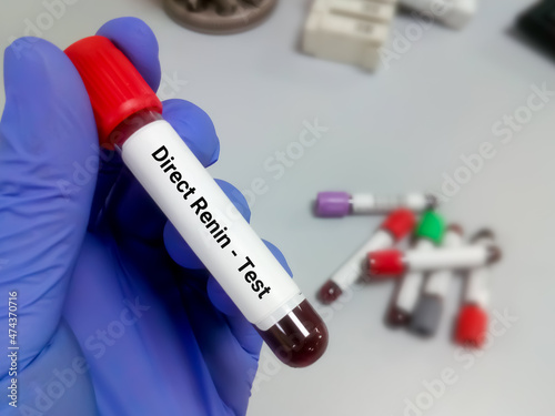 Blood sample tube for Direct renin test. CKD. Renin's primary function is therefore to eventually cause an increase in blood pressure, leading to restoration of perfusion pressure in the kidneys photo