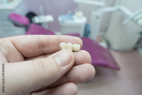 dental ceramic metal bridges in the hands