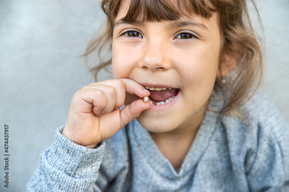 The child tooth fell out. Selective focus. Kid. The child tooth fell out. Selective focus. Kid.