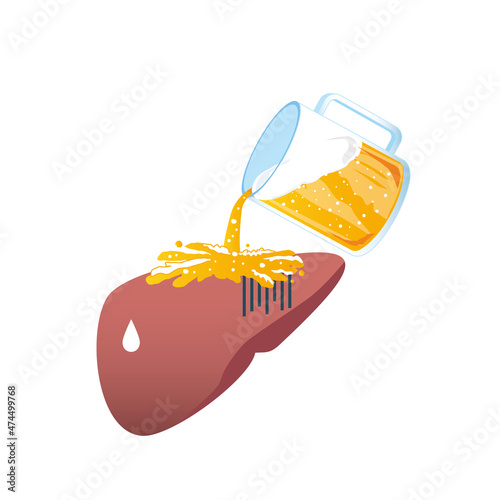 お酒で肝臓が悪くなるイメージ