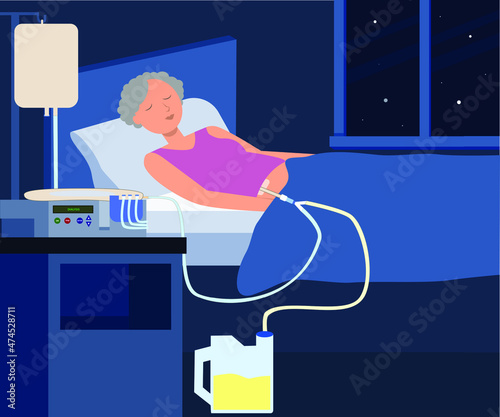 She on automated peritoneal dialysis during sleep, Nighttime, home.