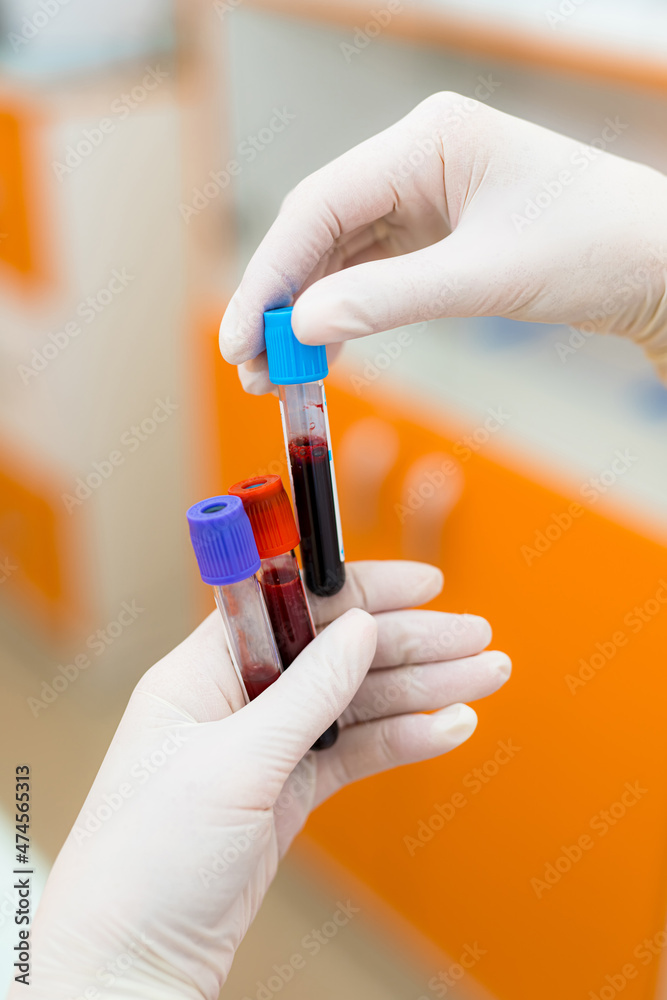 Hand holding blood in test tube. Medical blood test in tubes. Hand holding blood in test tube. Medical blood test in tubes.