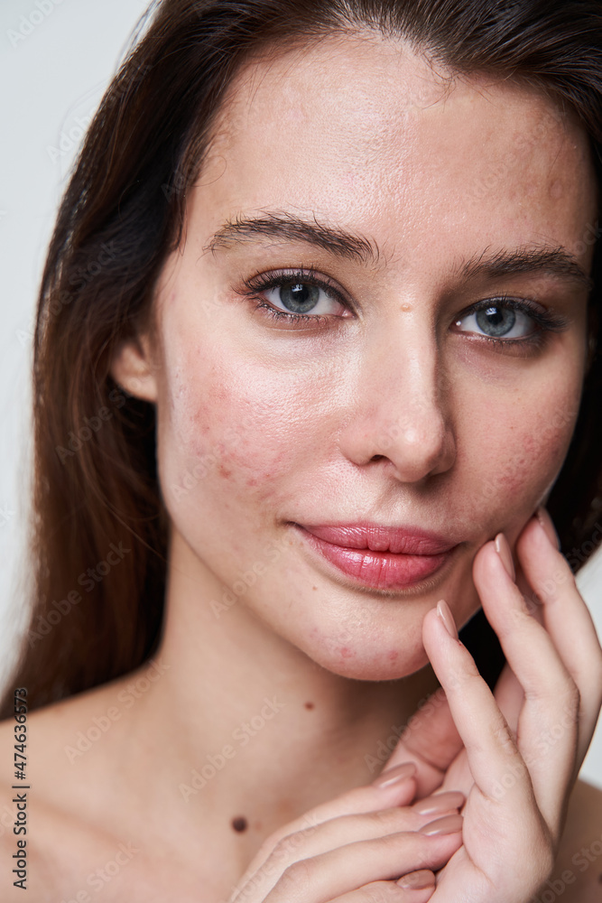Coquettish woman with blue eyes and skin imperfections smiling happily Coquettish woman with blue eyes and skin imperfections smiling happily
