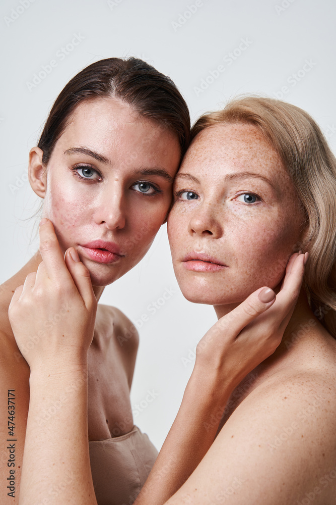 Two nude naked tender women bonding to each other while posing Two nude naked tender women bonding to each other while posing