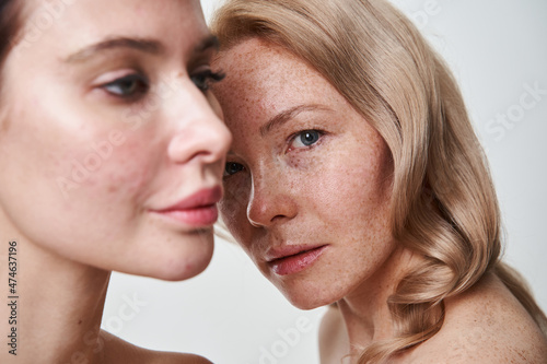 Females posing closely to each other while demonstrating their skin and appearance photo