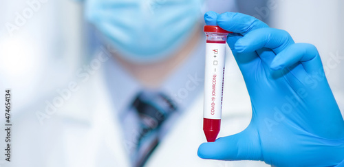 Doctor holding a test blood sample tube positive with Omicron variant, strain COVID-19.